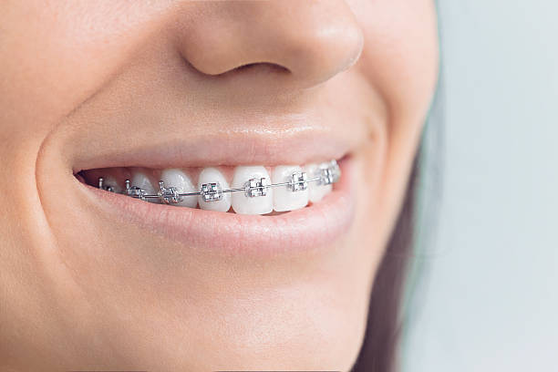 Best Full Mouth Reconstruction  in Milford Mill, MD